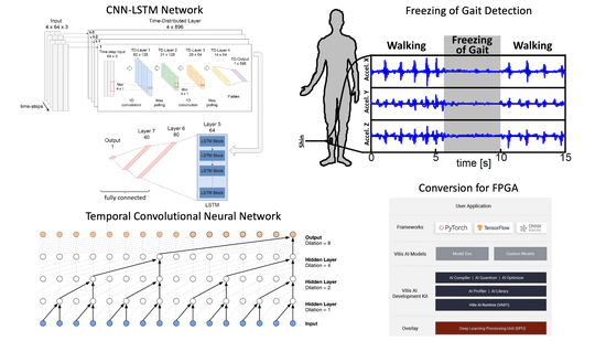 FPGA-Based Realtime Detection of Freezing of Gait in Parkinson Patients Using Neural Networks